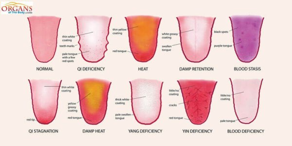 Мучнистая роса на комнатных