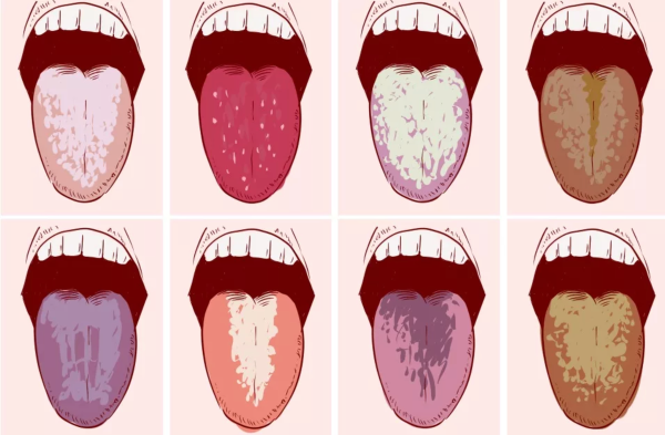 Робиния мучнистая роса