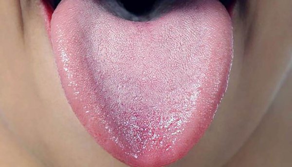 Патина окислившейся меди