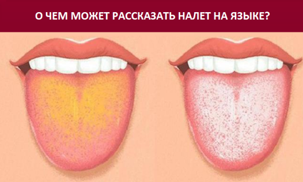 Какой язык при больной печени