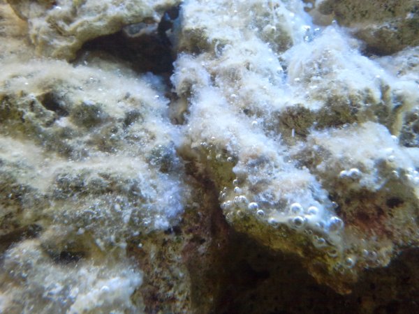 Кариес дентина глубокий