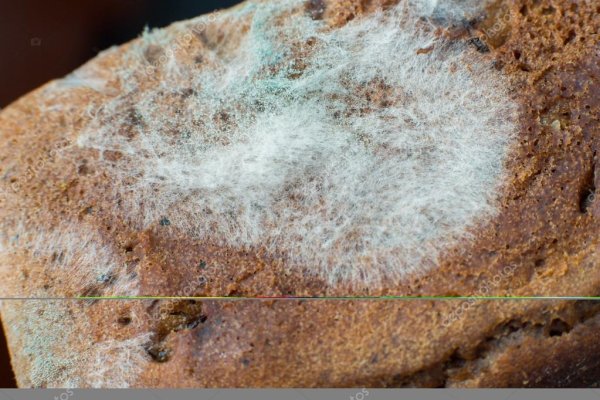 Бактерии зубного налета под микроскопом