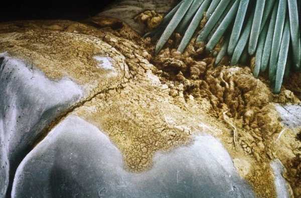 Болезни по языку определить