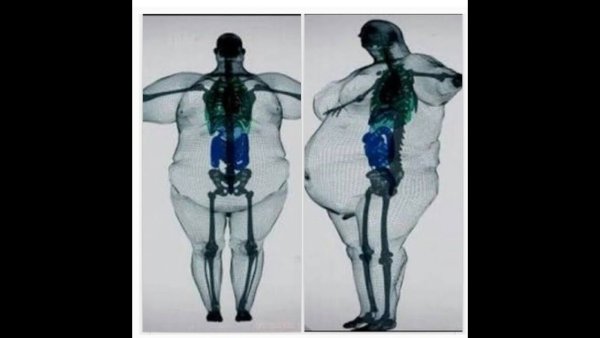 Кость широкая: тренировки и диета для эндоморфа