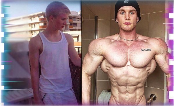 Зак Эйнсли до и после