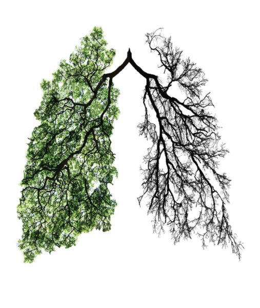 Деревья легкие планеты