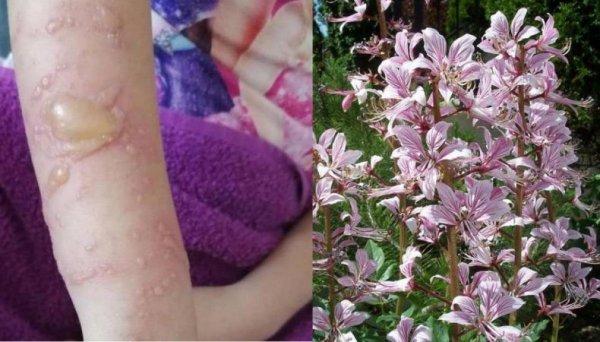 Ясенец Неопалимая Купина ожоги