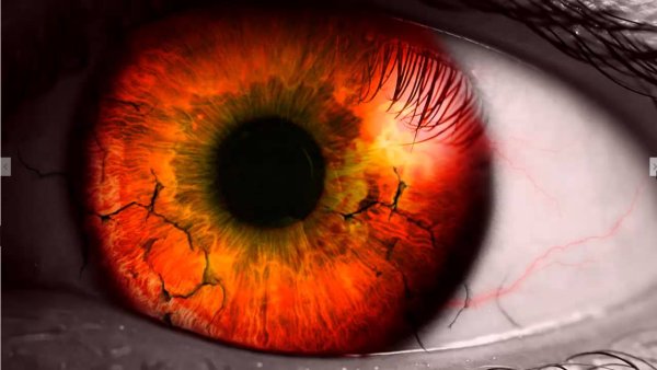 Оранжевые глаза