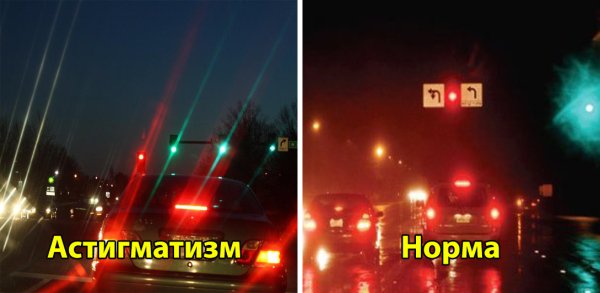 Астигматизм фонари