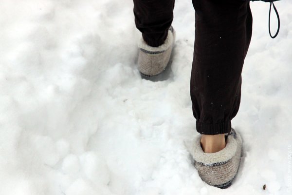 Открытые ноги зимой