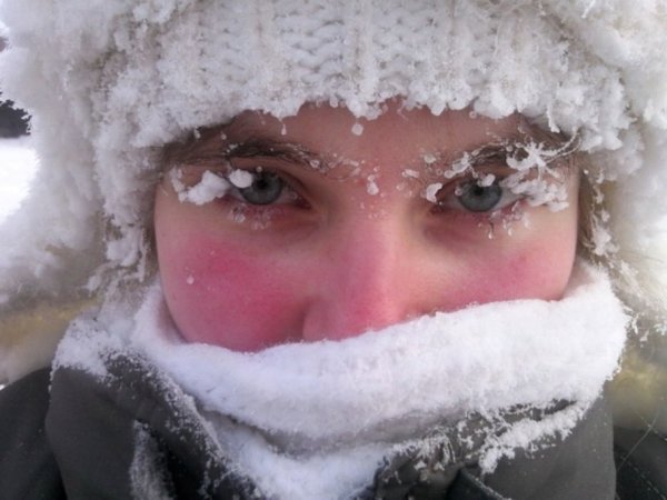 Красные щеки от Мороза