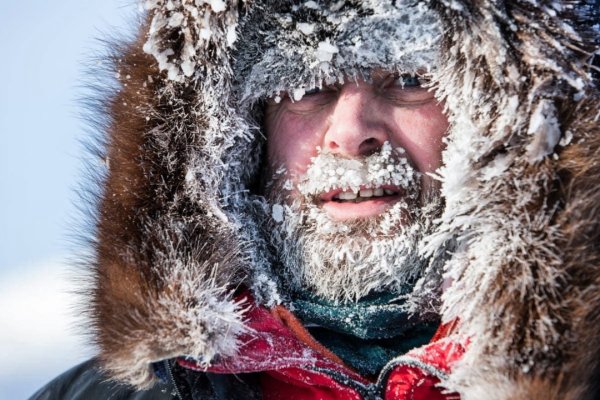 Иней на лице