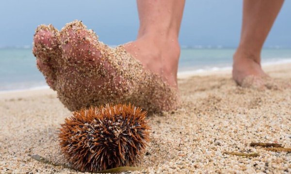 Наступа на морского ежа
